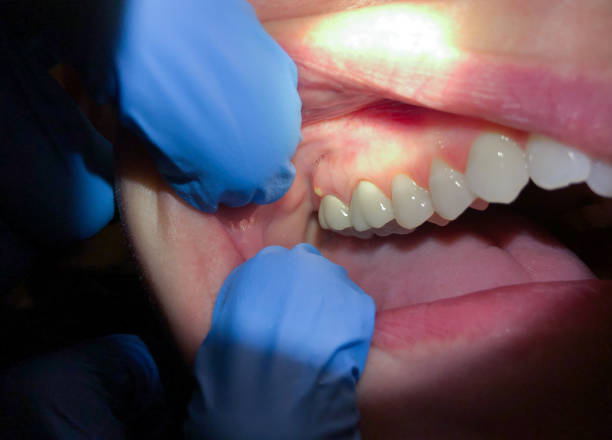 Best Urgent Care for Lost Fillings or Crowns in Trinity, FL